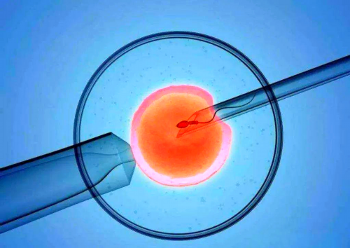 上海试管婴儿费用深度解析：在沪助孕的具体开销